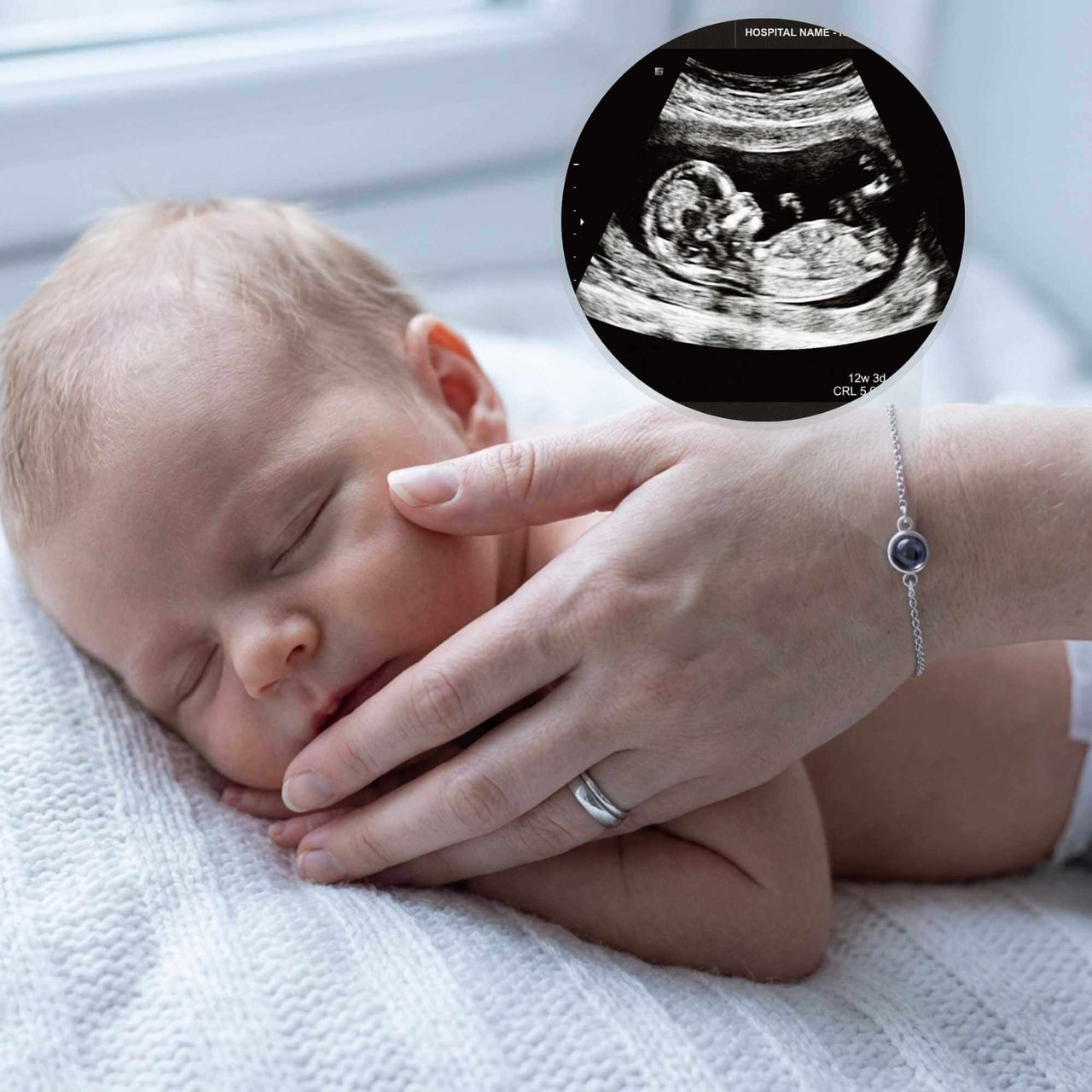 Photo Projection Bracelet featuring an ultrasound image and a sleeping baby, by Brother & Sisters.