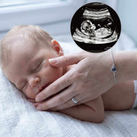 Thumbnail for Photo Projection Bracelet featuring an ultrasound image and a sleeping baby, by Brother & Sisters.